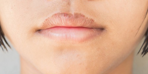 Sjögren’s Syndrome And Multiple Sclerosis: Differences And Similarities